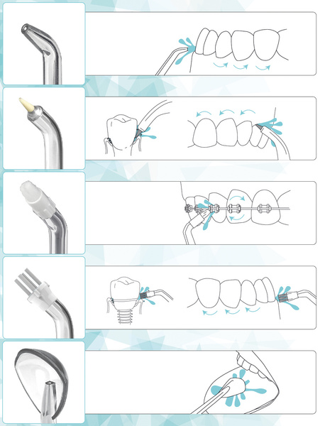Irygator dentystyczny do zębów i jamy ustnej bezprzewodowy ULTRACLEAN 4 + 6 końcówek